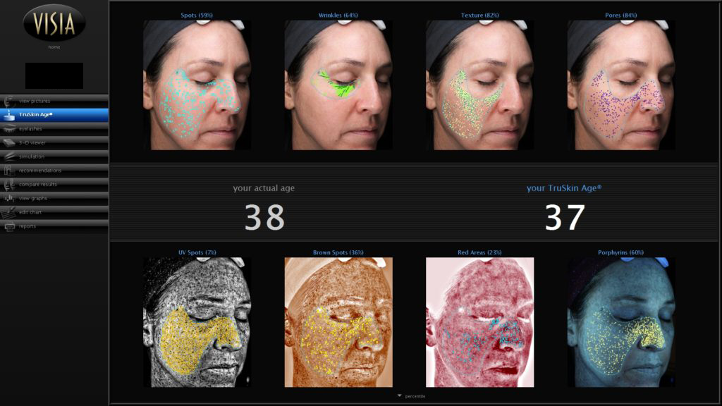 Scan After Treatment Scan After Treatment