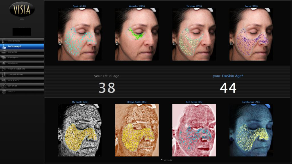 Scan Before Treatment Scan Before Treatment