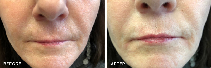 rest_before_after rest_before_after