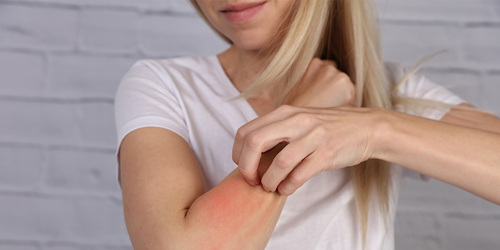 Woman scratching her arm