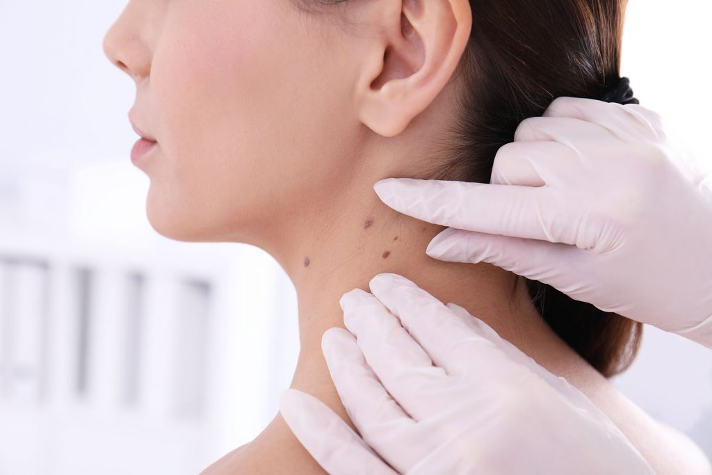 Dermatologist examining patient in clinic, closeup view