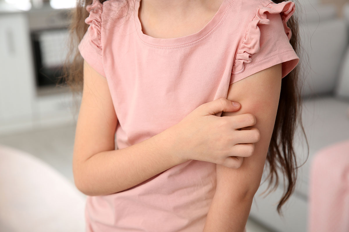 Children's Skin Rashes - Dermatology Associates of Plymouth Meeting