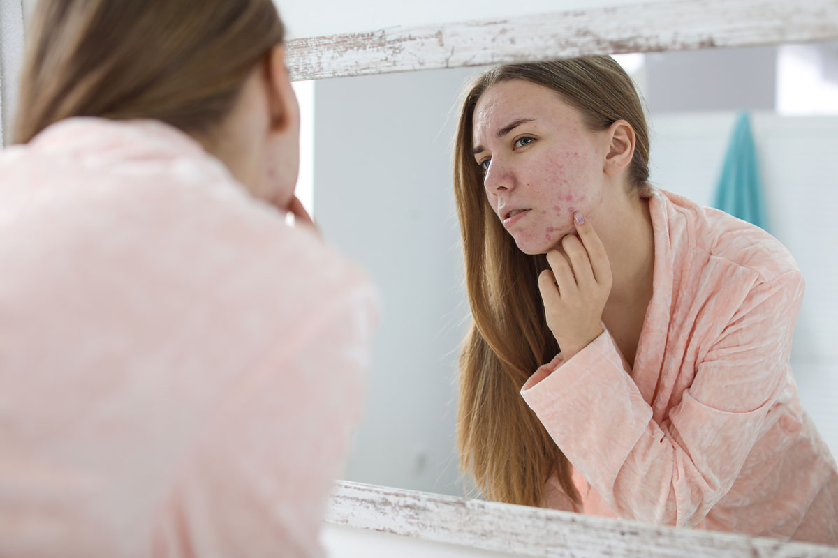 Young woman with acne problem near mirror in bathroom