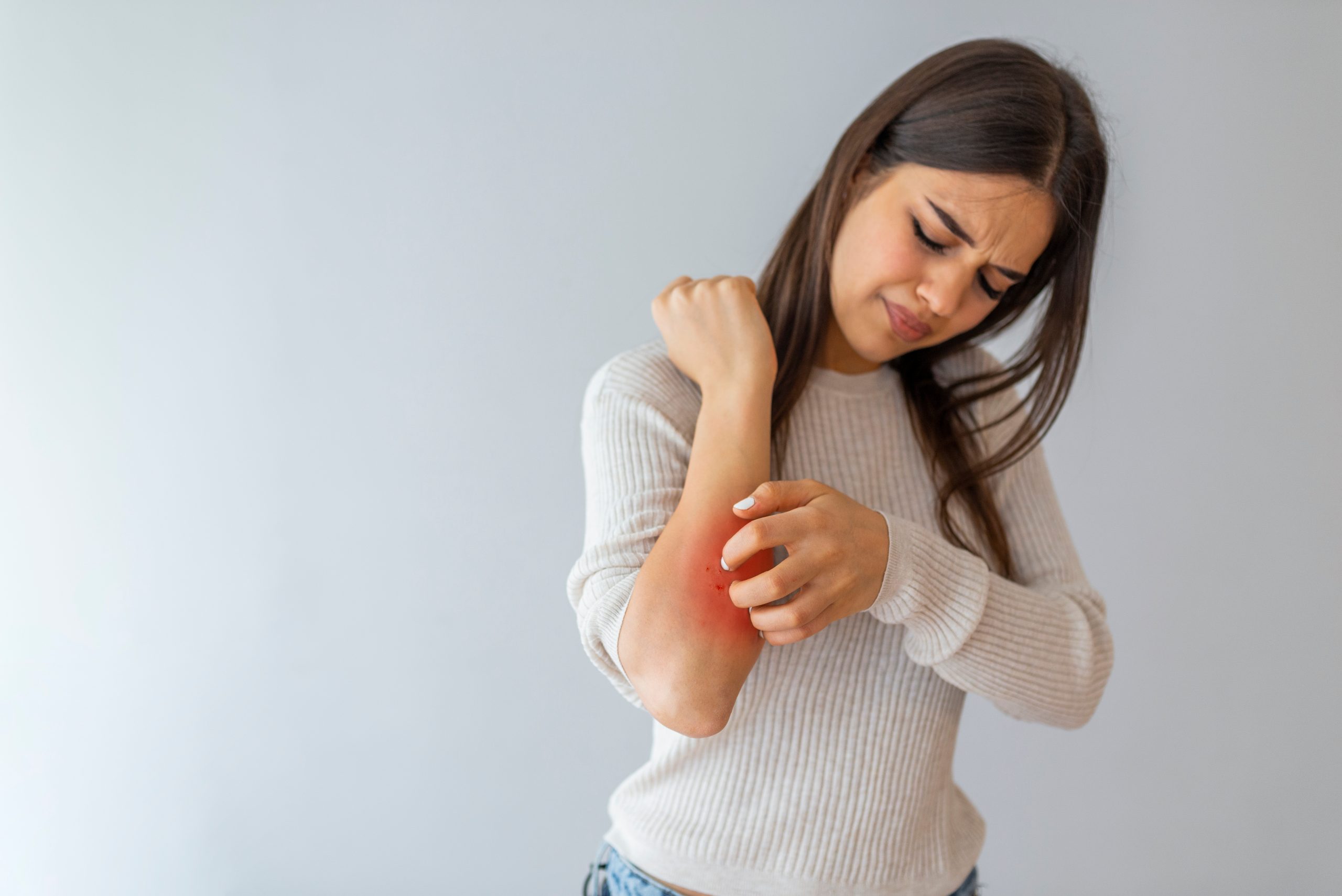 Woman scratching her itchy back with allergy rash Stock Photo by