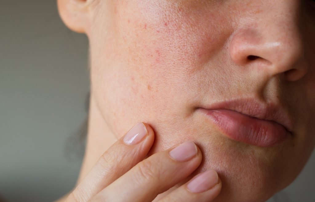 pores on the skin of the face. Cleansing the face skin