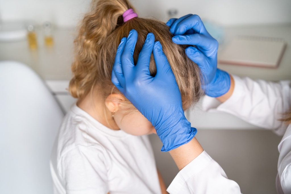 little girl at the reception of a dermatologist on examination of hair for lice, pediculosis little girl at the reception of a dermatologist on examination of hair for lice, pediculosis.